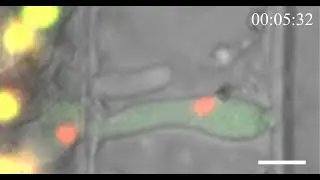 Extreme constriction and elongation of the rice blast fungal nucleus (www.khanglab.org)