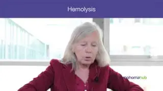 Case study: A challenging case of Waldenström macroglobulinemia