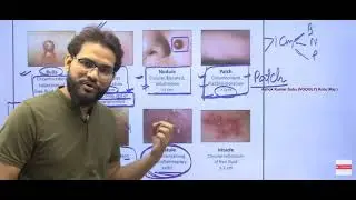 Bulla Macule Papule Pustul Nodule Vesicle Plaque Different Kind of Skin Lesions Full Class On VOOGLY