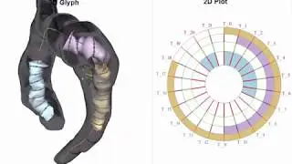 Semi‐automatic Vortex Flow Classification in 4D PC‐MRI Data of the Aorta