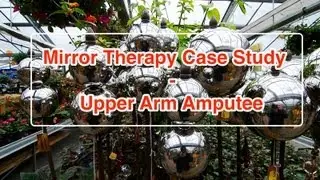 Mirror Therapy Case Study - Upper Arm Amputee