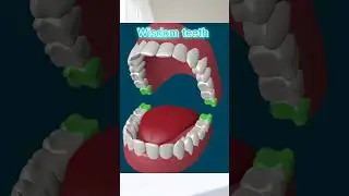 WISDOM TEETH - MEDICAL DEFINITION | Medical Consecutive Interpreting