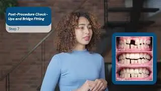 Dental Bridges in Turkey: Step-by-Step Guide
