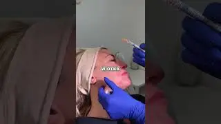Zabieg stymulatorem krok po kroku 💉✨