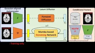 Several examples of brain structure changes generated by CLIMB model