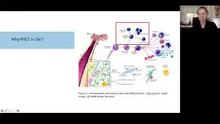 Progress in Cellular Therapies for Scleroderma