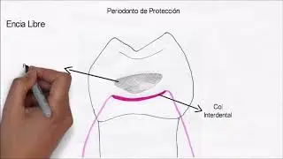 Periodonto de Proteccion
