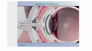 Dr Jaccoma Lipiview Short
