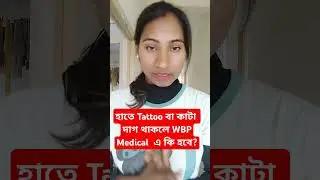 হাতে Tattoo বা কাটা দাগ থাকলে WBP Medical Exam এ Unfit হবে?।।#wbp #wbpconstable #wbpexam2025