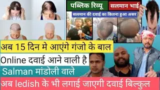 Salman मांडोली वाले अब आएंगे 15 दिन मे बाल 💇🏻‍♂️😱 Online दवाई आने वाली है कैसे जाये full information
