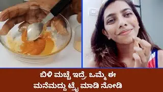Get Rid Of White Patches By Home Remedy | Vijay Karnataka