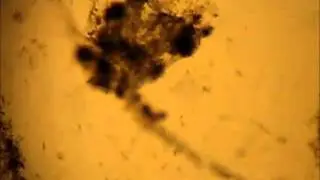 Acartia longiremis  worm from inside