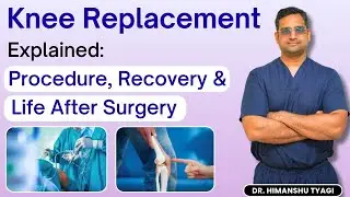 Knee Replacement Explained: Procedure, Recovery & Life After Surgery | | Life After TKR