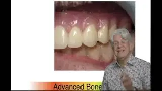 The Realities of Bone Grafting, Implant Placement & Soft Tissue Management Modular Trailer