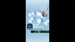 How to Get a Perfect Smile in Just 2 Visits | Porcelain Veneers & Crowns Explained