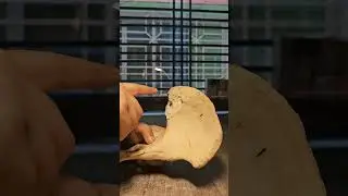 Hip bone (ilium)#1styearmbbslectures #anatomy #digestivesystem #liver