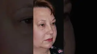 NECK LIFT Results That Changed EVERYTHING