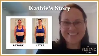 Kathie's Journey To Losing 74 lbs With The Sleeve Clinic