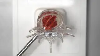 FlareHawk Bone Graft Demonstration