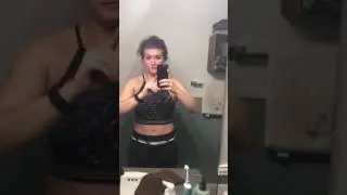 Tummy Tuck with dog ear revision about 4.5 mo post op