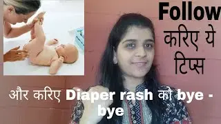 Diaper Rash - Causes, Prevention and treatment - Dr. Viragi