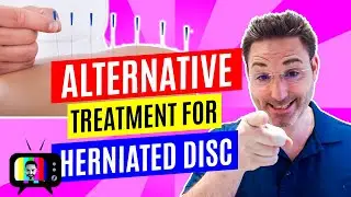 Alternative Treatments for Herniated Disc