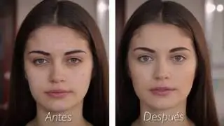 Cuidados y maquillaje para pieles con Acné y Rosácea