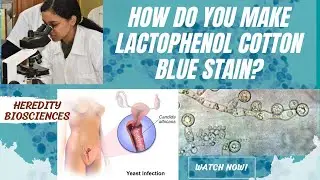 How do you make Lactophenol cotton blue stain? #hereditybioacademy