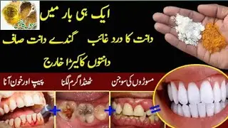 Get White Teeth Instantly 😁| Remove Tooth Pain, Cavity & Gum Swelling Naturally&rdquo;😃