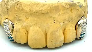 Gold diamond fang grillz with blue topaz