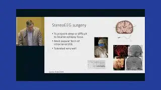 Epilepsy Research Matters: Updates & developments in Epilepsy treatments - Dr. Peter Widdess-Walsh