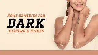 How To Remove Dark Patches On Elbows And Knees | Home Remedies