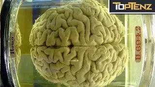 Top 10 Most FAMOUS Preserved BODY PARTS