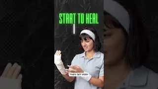 Why Do Healing Wounds Itch So Much?!