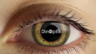 DinOptik - Mere brille for dine penge