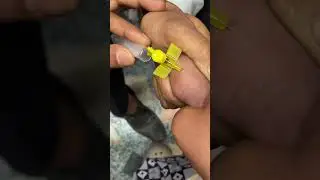 कैनुला से ब्लड निकालना सीखे | how to blood collection in cannula #blood #cannula