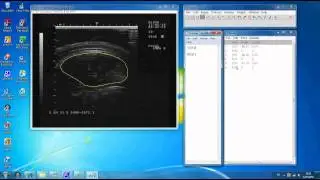 Loin Eye Area Calculation from ImageJ Image Analysis Software
