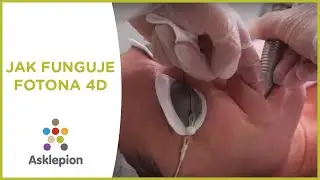 Jak FUNGUJE laser FOTONA 4D?