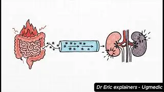 shigella