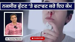 ਨਕਸੀਰ ਫੁੱਟਣ &lsquo;ਤੇ ਫਟਾਫਟ ਕਰੋ ਇਹ ਕੰਮ | Nakseer | Dr Sunny Narula |