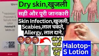 halotop s lotion uses | halotop s cream in hindi | halotop s | halotop f cream | halotop s ointment