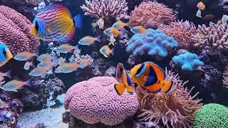 Beautiful Relaxing Music - Calm Nerve Music, Overcome Overthinking, Heart Therapy, Relaxation