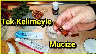 Sivilce İzleri Güneş ve Cilt Lekelerine Gözenek Problemlerine İyi Gelen Krem ||Kusurları YOK Et