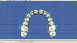 Grabowski Orthodontics: SureSmile