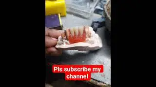 Lower interior 3 unit removable partial denture By Nandan #dental art by nandan#rpd#dentures#dentist