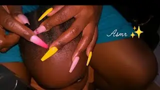 Long Nail Scalp Scratching and Nitpicking ASMR ✨