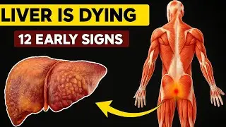 Liver Damage WARNING: 12 Weird Signs You&rsquo;re in Danger