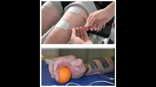 Use of electrical stimulation in SCI to maintain, improve range of motion & strength - Feb. 27, 2021