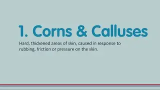 College of Podiatry's 5 Common Foot Conditions: Corns & Calluses