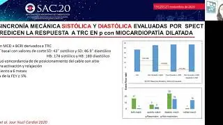 Disincronia ventricular